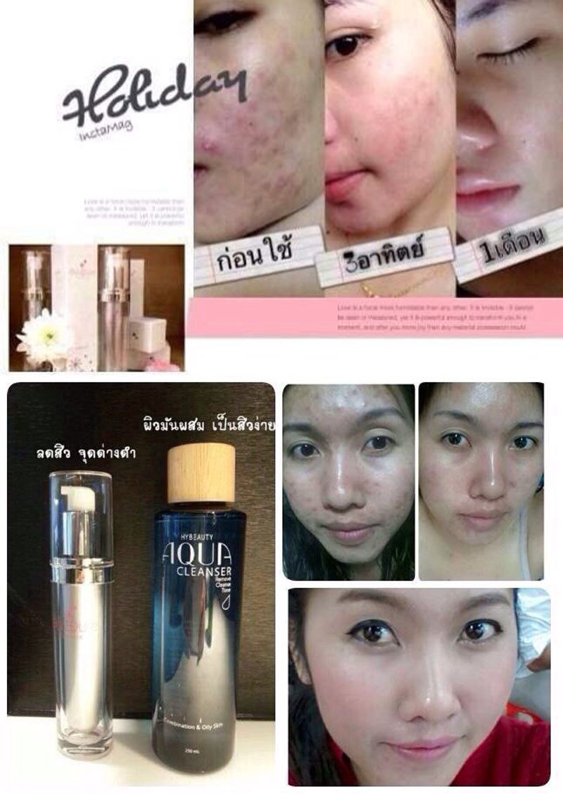 HyBeauty Aura Pure Essence (Aura pure serum) ขนาด 10 ML.  ลดสิว เพื่อผิวขาว สว่าง กระจ่างใสดุลออร่า