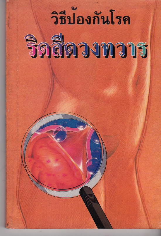 วิธีป้องกันโรค ริดสีดวงทวาร