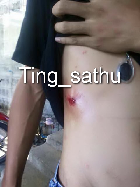 20.ประสบการณ์ !! หลวงพ่อเปิ่น วัดบางพระ เหรียญรูปไข่เนื้อทองแดง รุ่นมหาเศรษฐี พ.ศ. 2534 ตอกโค้ด